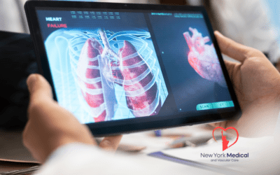 How AI Is Revolutionizing Heart-Disease Prediction & Patient Care in New York City